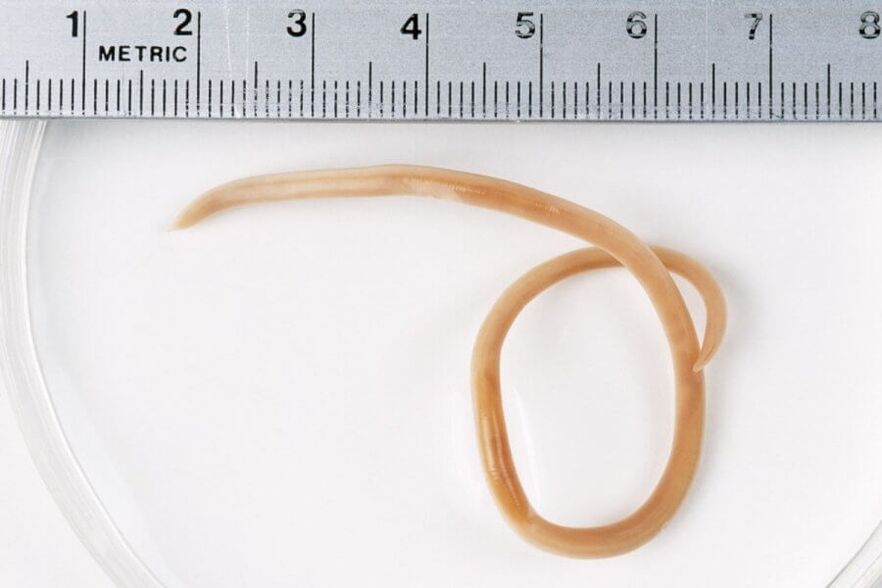 Ascaris je guľatý červ žijúci v ľudskom tele
