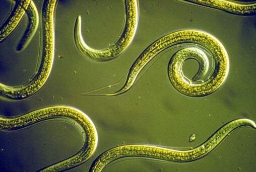 Parazitické nematódové červy v ľudskom tenkom čreve