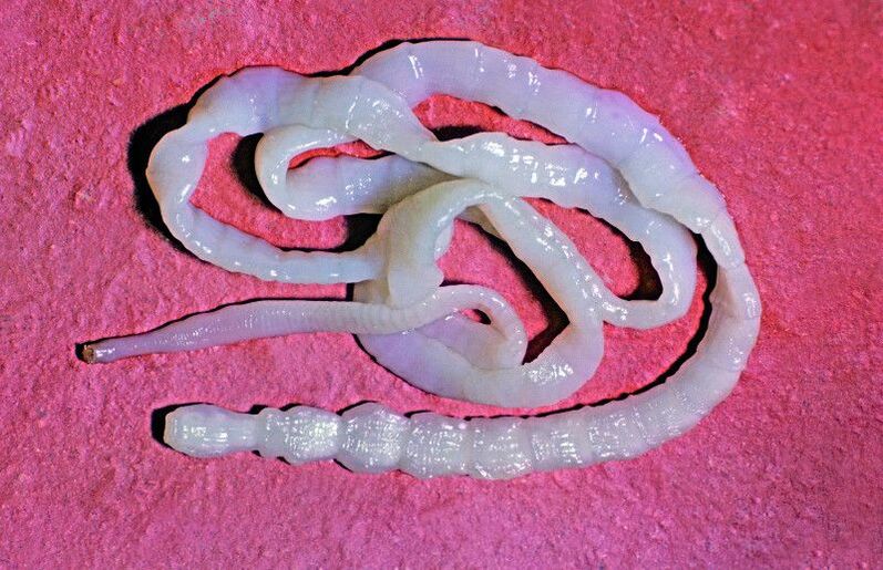 Pásomnica hovädzia je bežný črevný červ